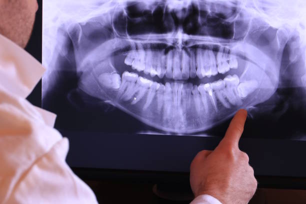 Best Emergency TMJ Treatment in Fredonia, WI
