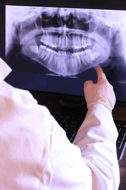 Best Emergency Denture Repair in Fredonia, WI